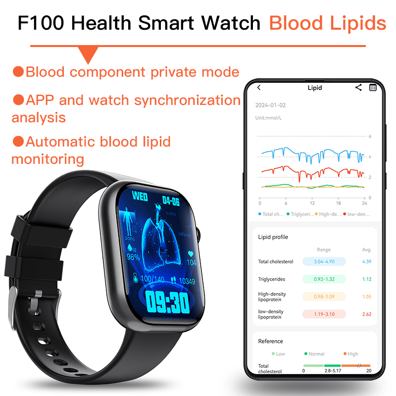 Best ECG Smart Watch of 2025 With Blood Pressure Monitor+Blood Glucose Monitoring - Smart Gadgets